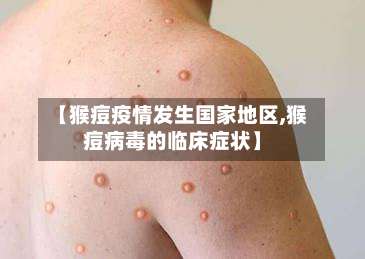 【猴痘疫情发生国家地区,猴痘病毒的临床症状】-第2张图片